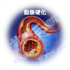 全身への影響B【動脈硬化】