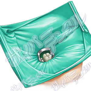 歯内治療【ラバーダム】