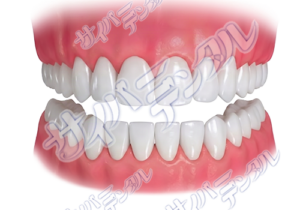 オフィスホワイトニング【白い歯】