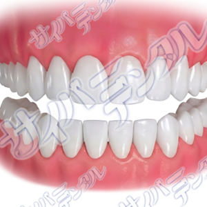 オフィスホワイトニング【白い歯】