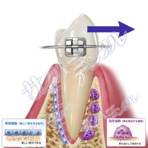 矯正【動く仕組み】2